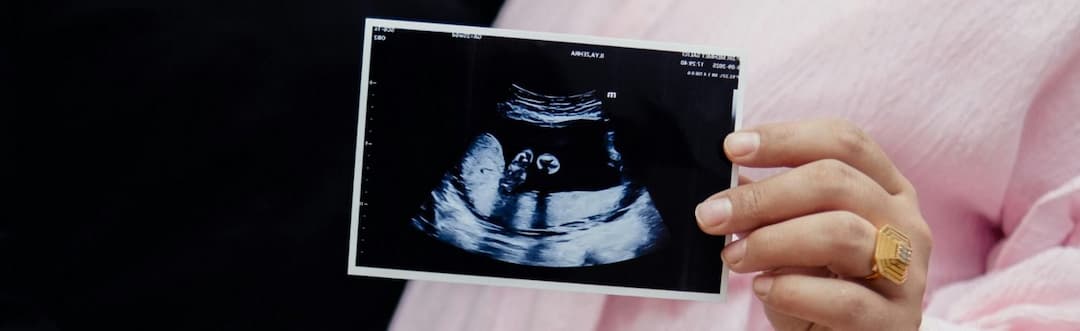 Fetal Assessment Banner Image