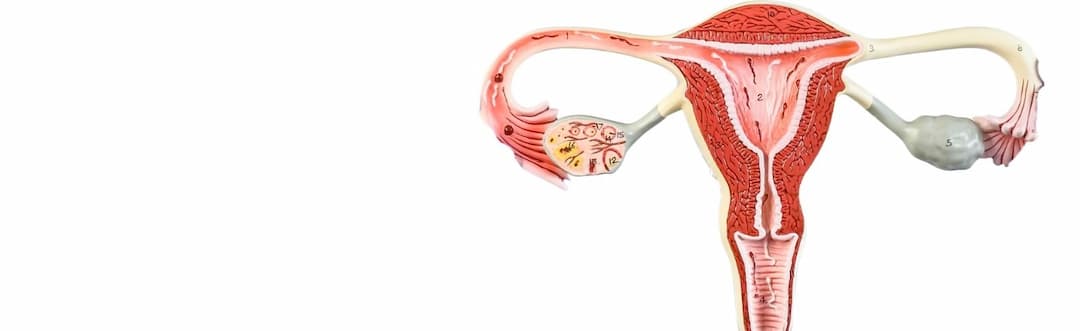 Polycystic Ovary Syndrome PCOS Banner Image
