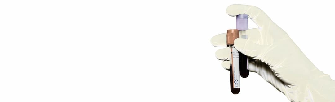 Prenatal Testing Banner Image
